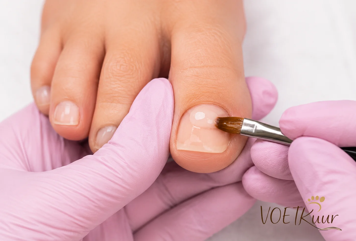 Voetkuur Affligem | Onychoplastie – Nagelherstel Of Nagelopbouw Tecniek